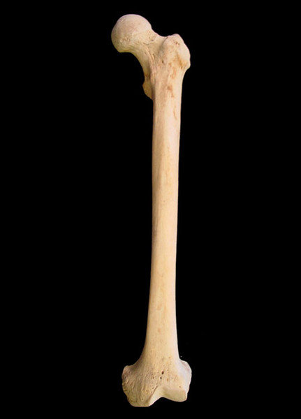 bone_femur.jpg