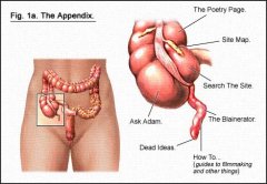 alpendectomy